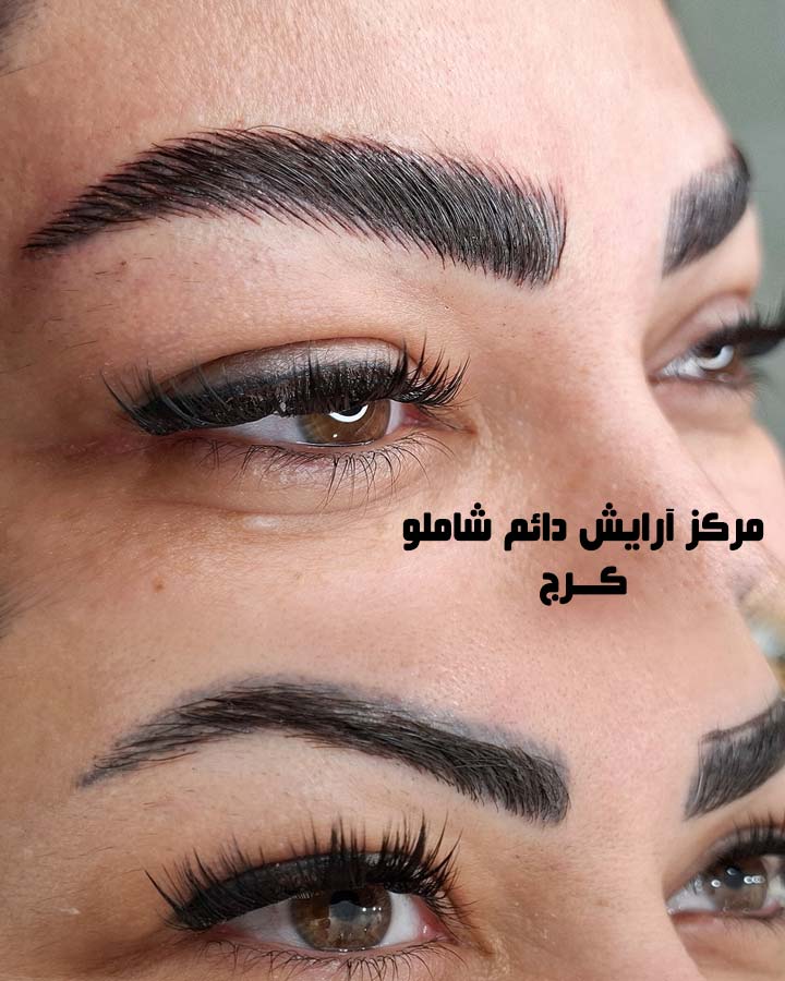 بهترین مرکز میکروبلیدینگ ابرو در کرج (10) بهترین مرکز میکروبلیدینگ ابرو در کرج
