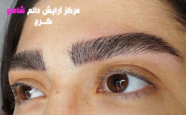 بهترین مرکز میکروبلیدینگ ابرو در کرج ترمیم میکروبلیدینگ ابرو، بهترین مرکز میکروبلیدینگ ابرو در کرج