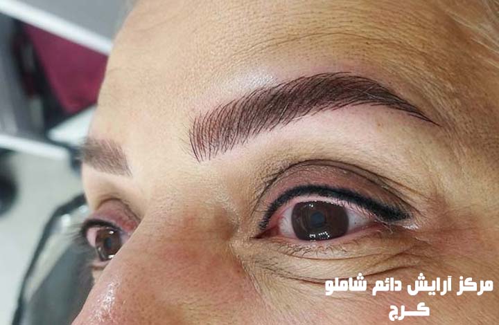 بهترین مرکز میکروبلیدینگ ابرو در کرج