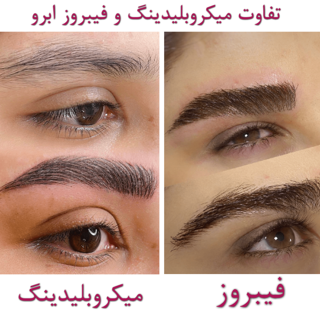 تفاوت میکروبلیدینگ و فیبروز ابرو