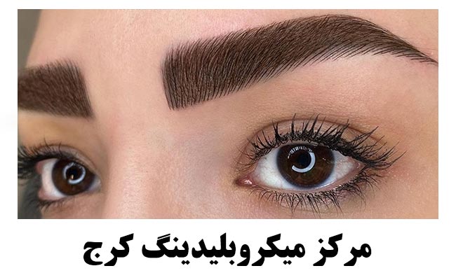 بهترین مرکز میکروبلیدینگ ابرو در کرج